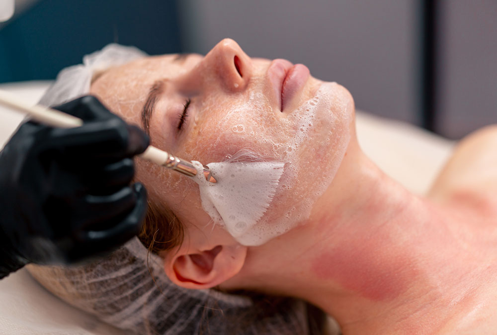 Medical skin treatments and chemical peels in Bali