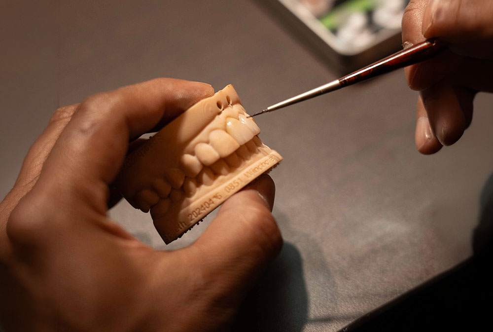 In-house dental laboratory for crowns, bridges and implant restorations in Bali